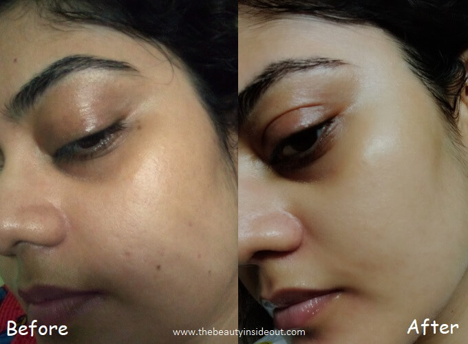 Before After Using Minimalist Granactive Retinoid 